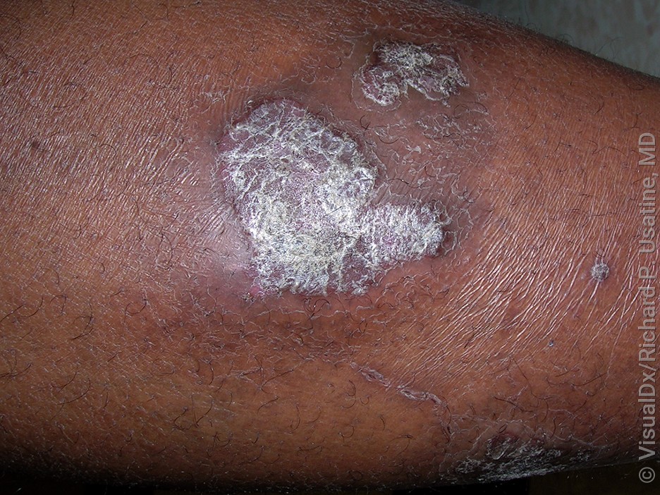 Clinical Presentation